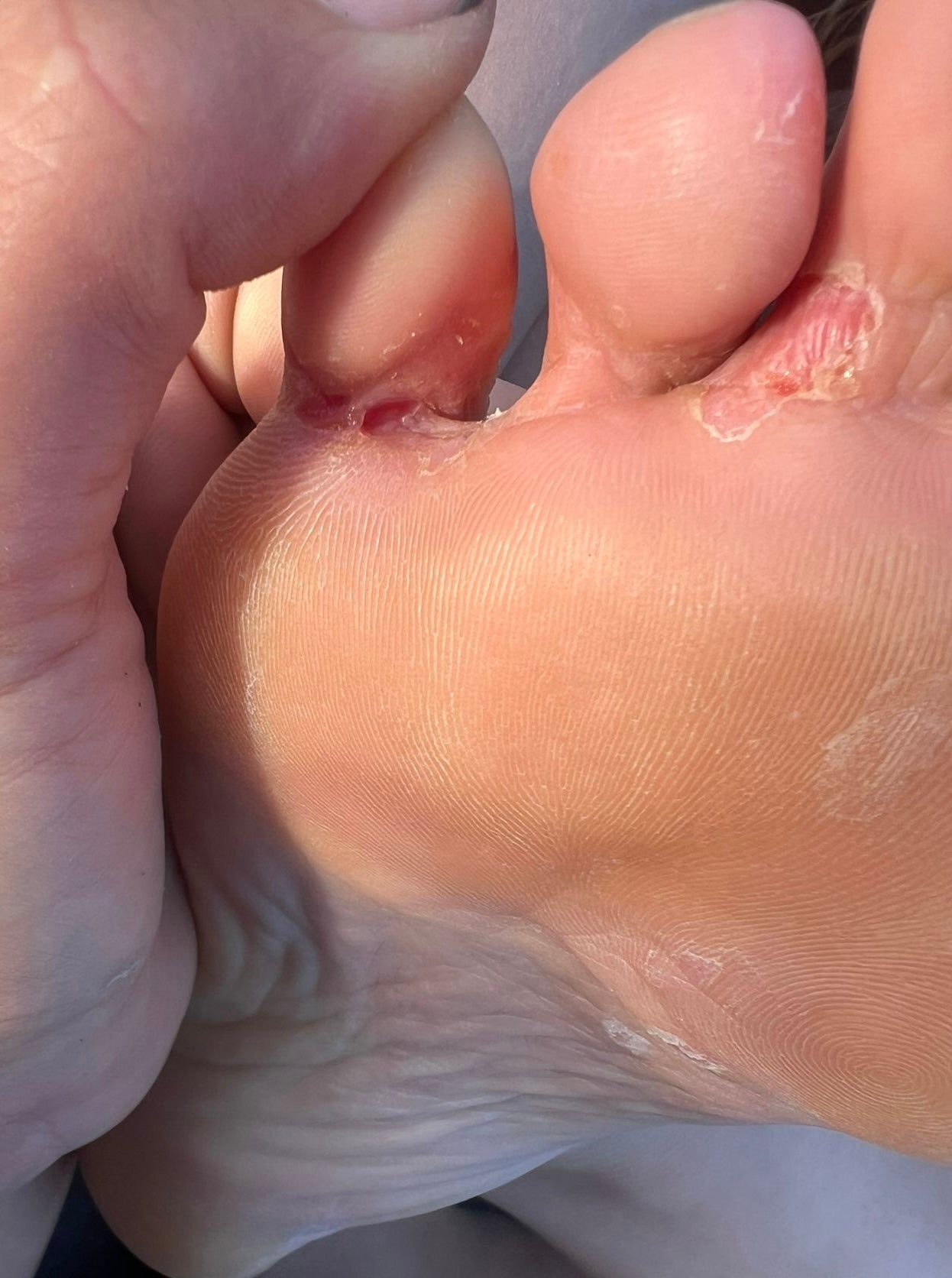 The Ultimate Guide to Managing Dry Skin Year-Round
