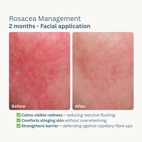Skin Rescue Moisturiser - 200ml