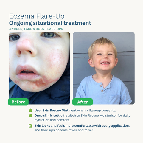 Skin Rescue Ointment  & Moisturiser Bundle
