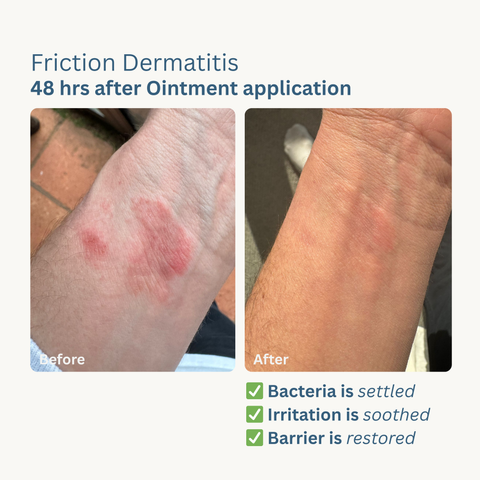 Skin Rescue Ointment - 50ml