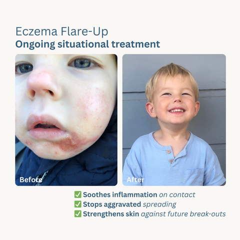 Skin Rescue Ointment - 50ml