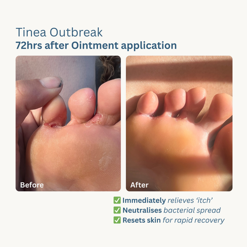 Skin Rescue Ointment - 50ml