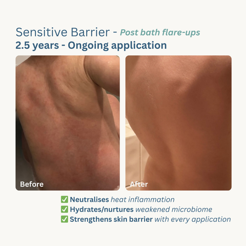 Skin Rescue Moisturiser - 200ml