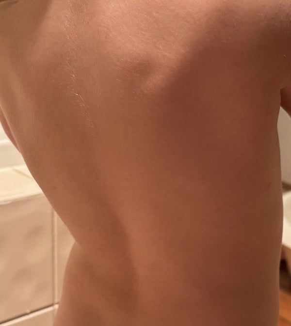 After
